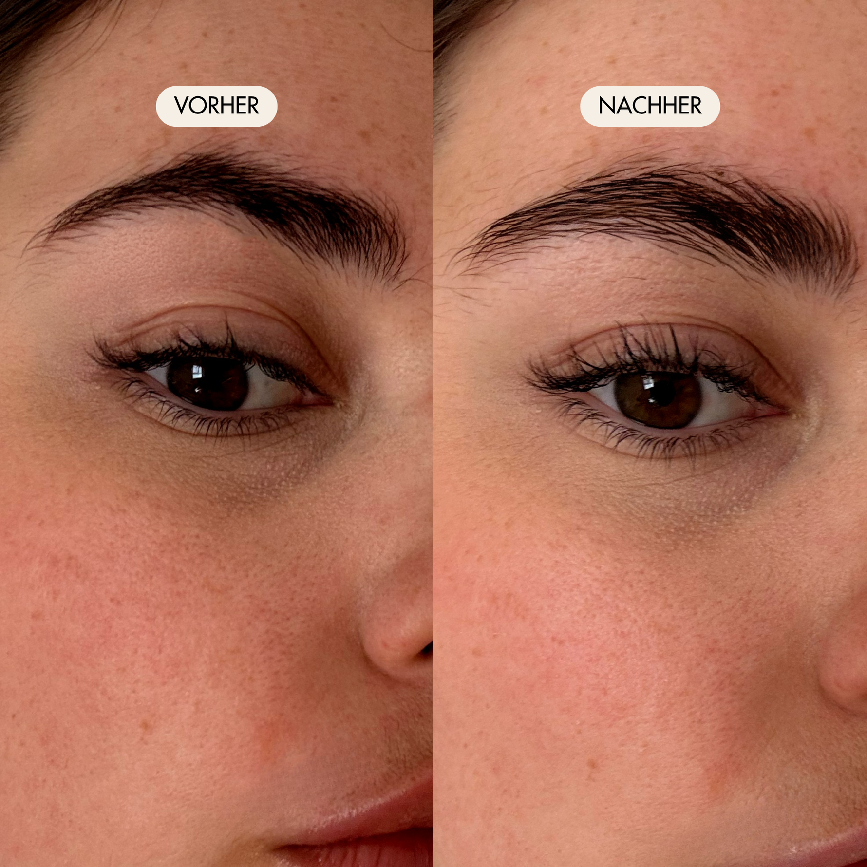 Vorher-/Nachher Vergleichsbild zeigt definierte und kräftigere Augenbrauen nach der Anwendung des Full Brow Augenbrauenserums