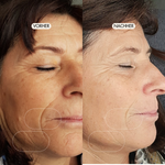 Vorher-/Nachher Vergleichsbild zeigt weniger tiefe Falten nach der Anwendung des Blossom Beauty Anti-Aging Drink