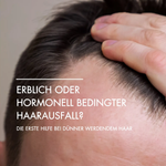 Nahaufnahme von einer Kopfhaut mit dünnem Haar und Geheimratsecken. Daneben steht in weißer Schrift: "Erblich oder hormonell bedingter Haarausfall? Die erste Hilfe bei dünner werdendem Haar"