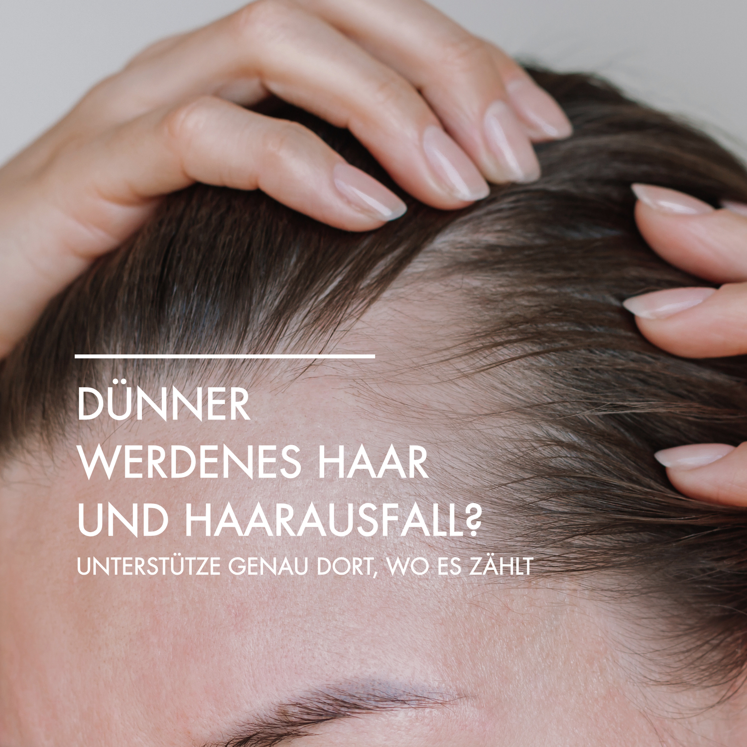 Nahaufnahme von einer Kopfhaut mit dünnem Haar und Geheimratsecken. Daneben steht in weißer Schrift: "Dünner werdenes Haar und Haarausfall? Unterstütze genau dort, wo es zählt"