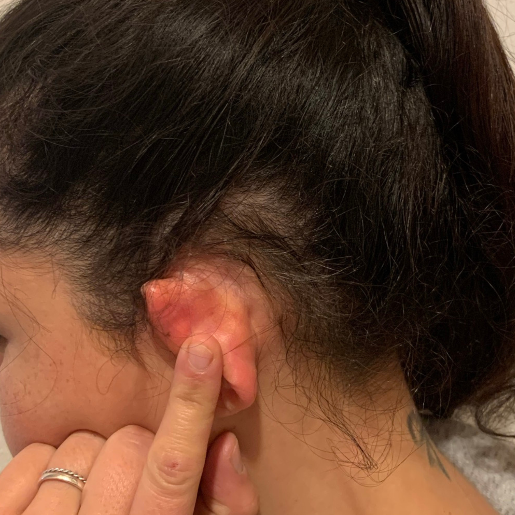 Nachher-Vergleichsbild zeigt deutlich dichtere Haare und mehr Haarwuchs hinter den Ohren am Haaransatz nach der Anwendung des Haarwuchsmittel
