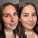Vorher-/Nachher Vergleichsbild zeigt sichtbar strahlende, erholte und gepflegte Haut nach der Anwendung der Hyalove Gesichtscreme