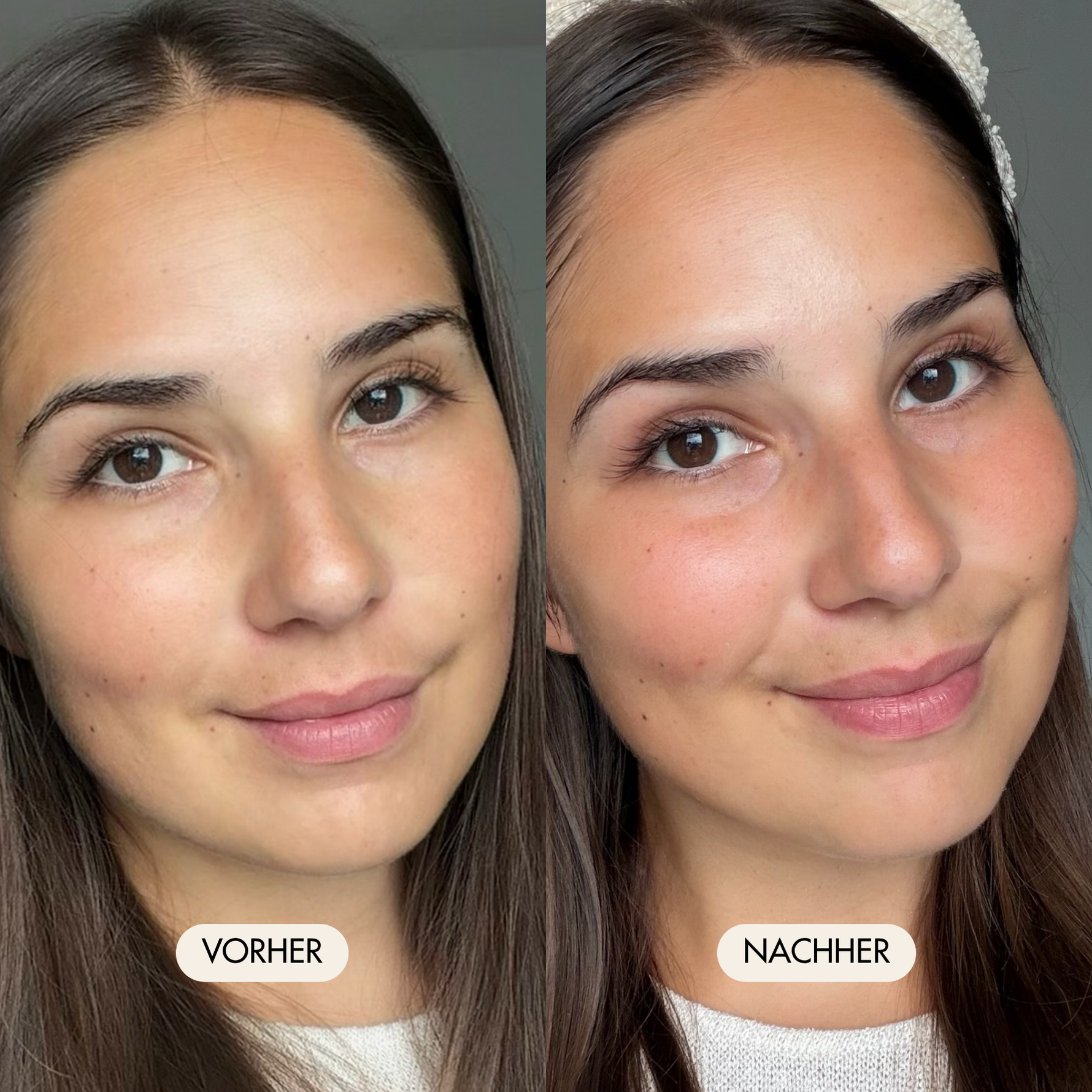 Vorher-/Nachher Vergleichsbild zeigt erholte und strahlende Haut  nach der Anwendung der Hyalove Glas Skin Routine