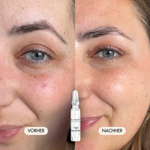 Vorher-/Nachher Vergleichsbild zeigt reduzierte Augenringe, Augenfalten, Trockenheitsfalten rund um die Augen nach der Anwendung der High Expression Wirkstoff Ampulle von Dr. Massing Cosmetics