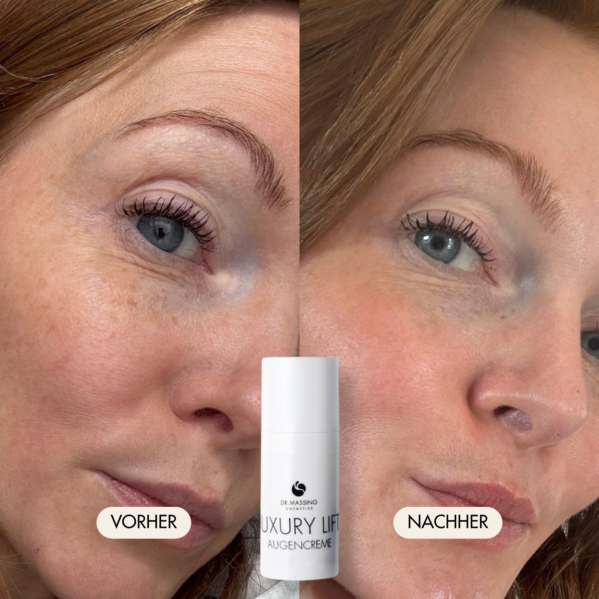 Vorher-/Nachher Vergleichsbild zeigt reduzierte Falten, Trockenheitsfalten und Krähenfüße rund um die Augen nach der Anwendung des Luxury Lift Augencreme von Dr. Massing Cosmetics