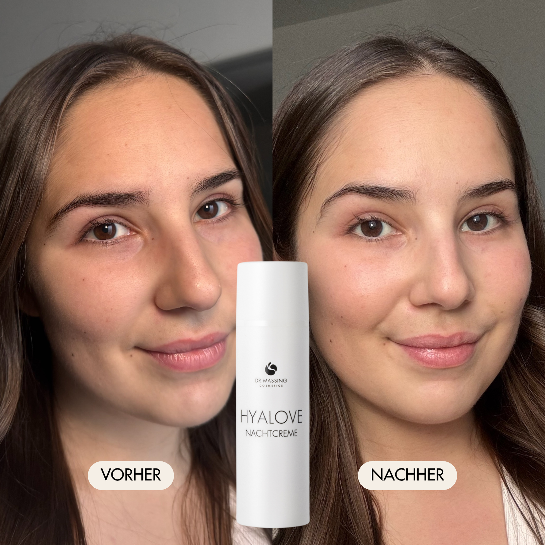 Vorher-/Nachher Vergleichsbild zeigt erholte und strahlende Haut nach der Anwendung der Hyalove Nachtcreme