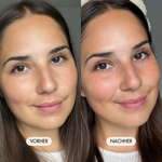 Vorher-/Nachher Vergleichsbild zeigt strahlende und gepflegte Haut nach der Anwendung des Hyalove Hyaluronserums