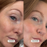 Vorher-Nachher Bild einer jungen Frau, die Luxury Lift Augencreme angewendet hat. Die Falten, schwellungen und dunkle Stellen ums Auge sind deutlich reduziert