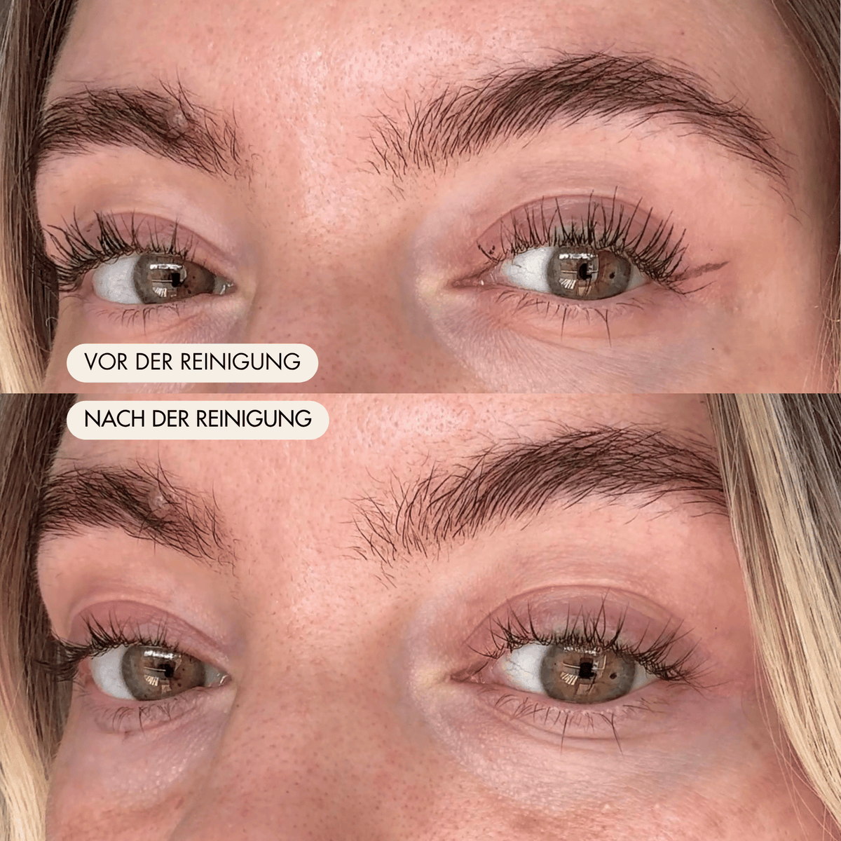 Vorher Nachher Ergebnis LongLashes Eye Cleanser