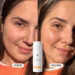 Vorher-/Nachher Vergleichsbild zeigt strahlende, frische und erholte Haut nach der Anwendung mit dem Payalove Toner