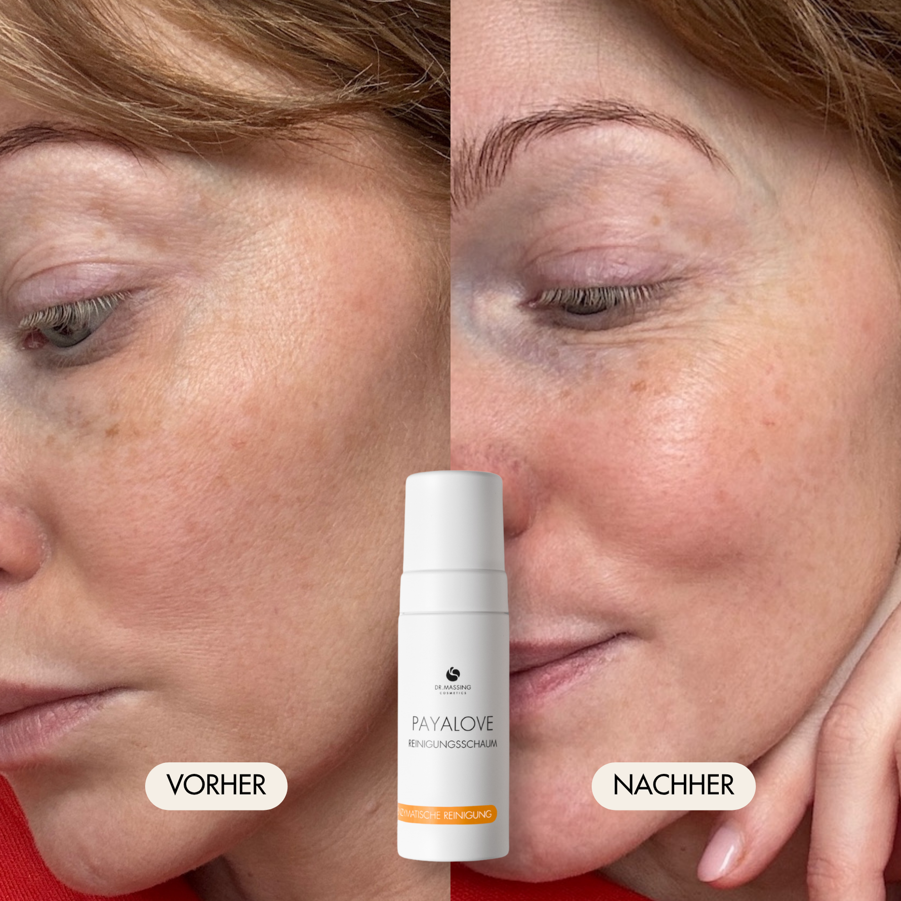 Vorher-/Nachher Vergleichsbild zeigt strahlende, frische und gereinigte Haut nach der Anwendung mit dem Payalove Cleanser
