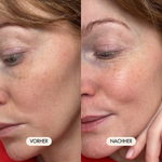 Vorher-/Nachher Vergleichsbild zeigt strahlende, frische und gereinigte Haut nach der Anwendung mit dem Payalove Cleanser