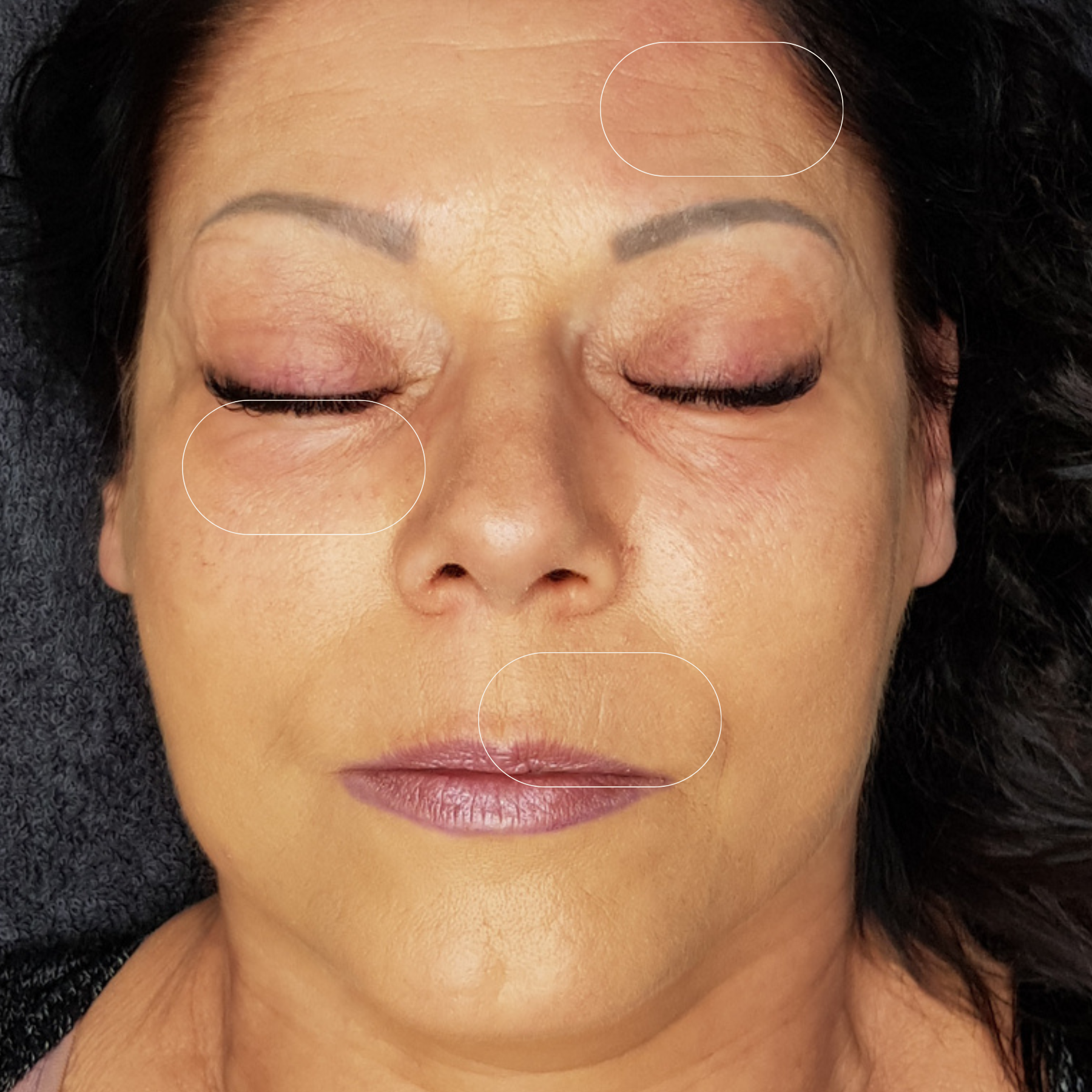 Vergleichsbild nach der Anwendung des Blossom Beauty Anti-Aging Drink