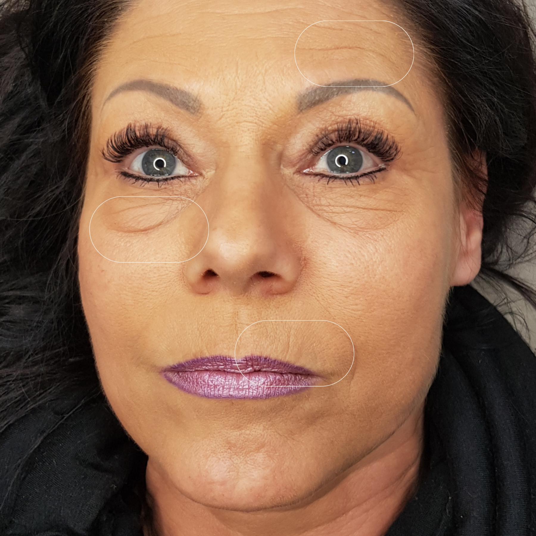 Vergleichsbild vor der Anwendung des Blossom Beauty Anti-Aging Drink