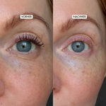 Vorher-/Nachher-Vergleich für den Eye-Cleanser von Dr. Massing