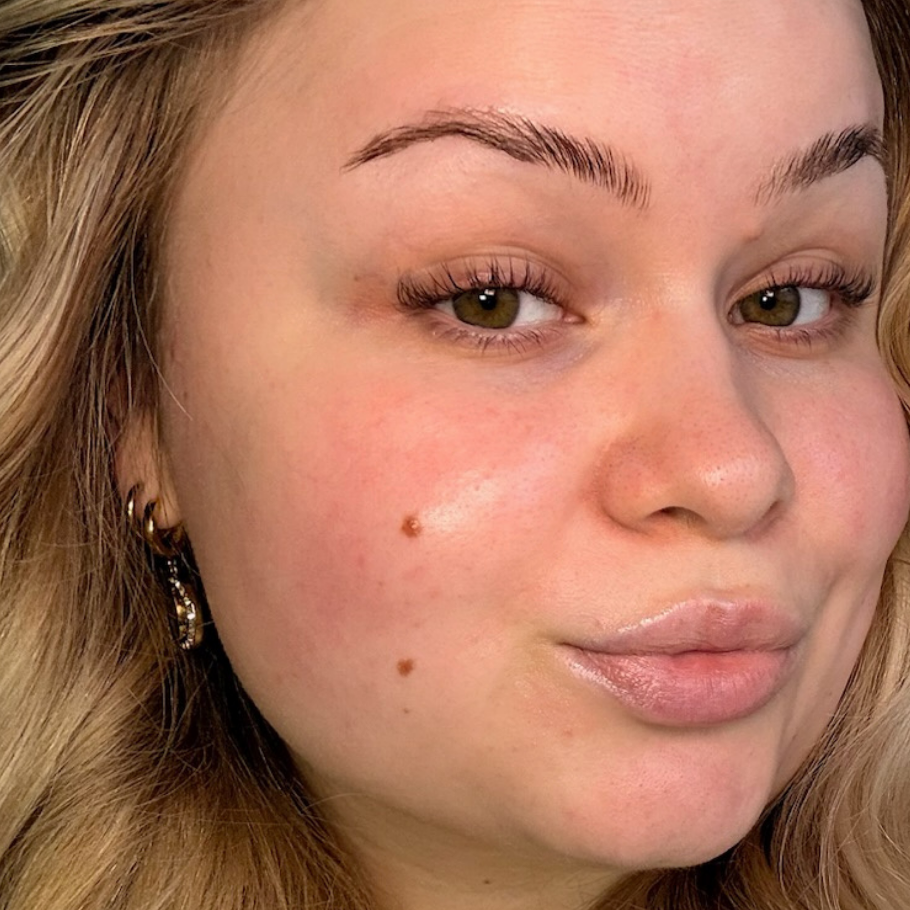 Junge Frau mit strahlender, gepflegter und schöner Haut nach der Anwendung des Hyaluronserums