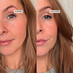 Vorher-Nachher Bild einer jungen Frau, die Luxury Lift Augencreme angewendet hat. Die Falten, schwellungen und dunkle Stellen ums Auge sind deutlich reduziert