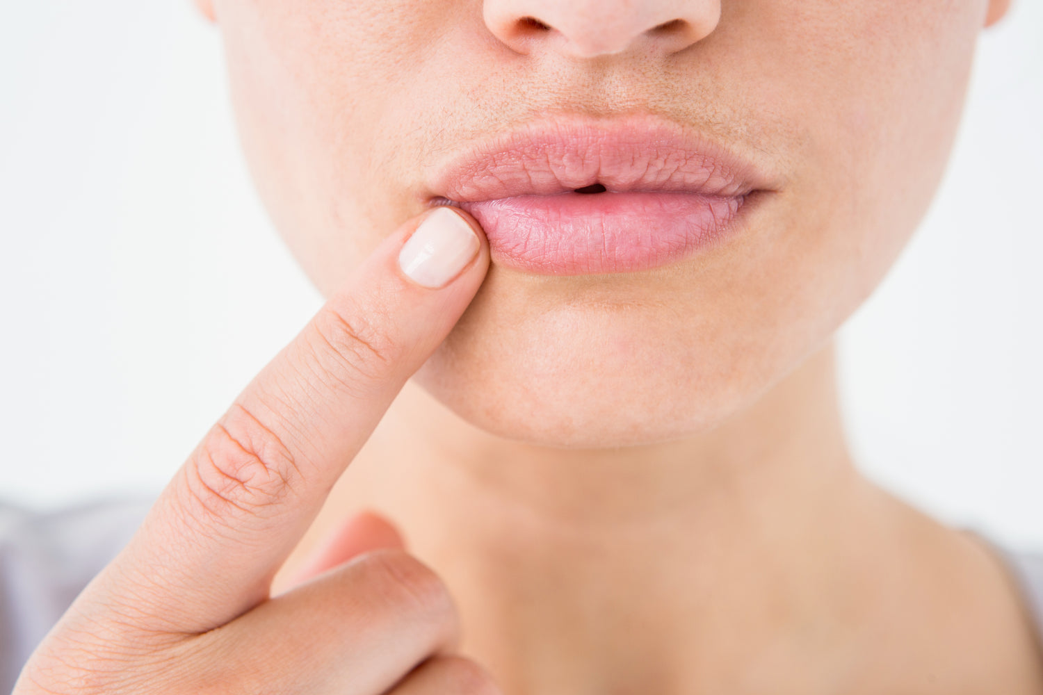 Frau hält einen Finger an ihre trockenen Lippen