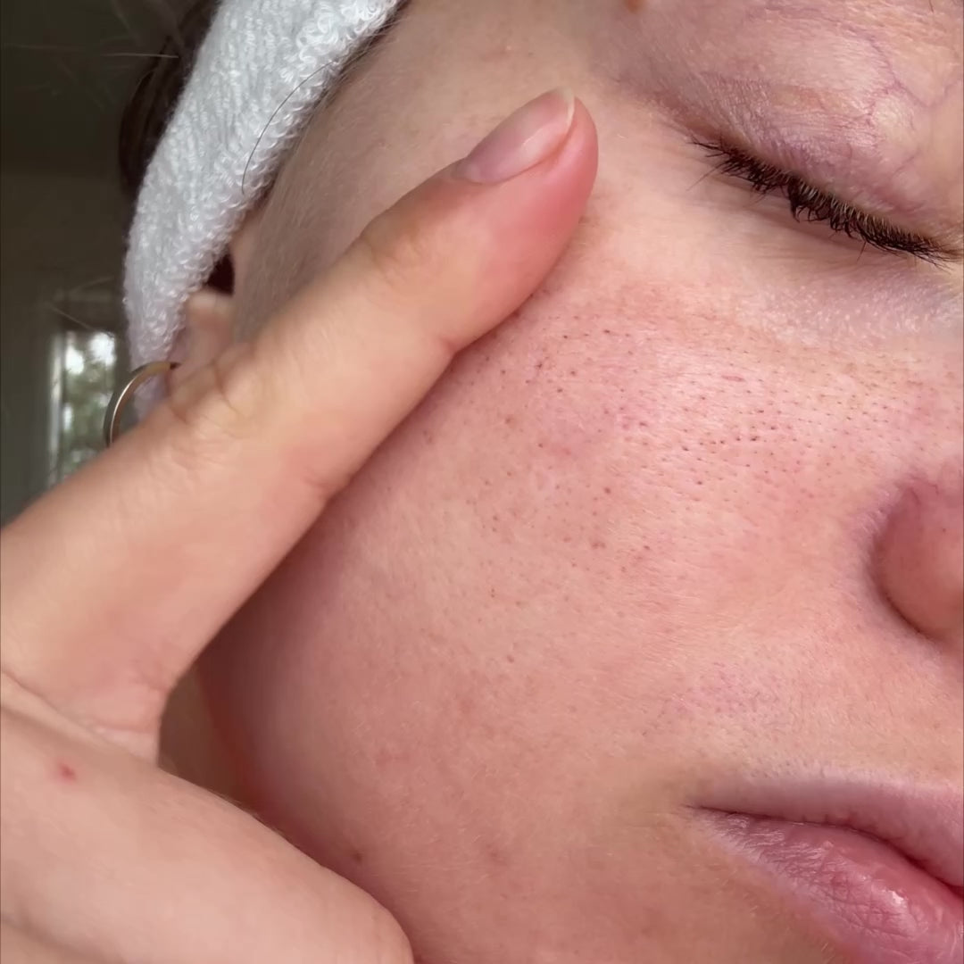 Nahaufnahme einer Frau mit starken Poren zeigt vorher nachher Ergebnis nach Reinigung mit dem Payalove Cleanser