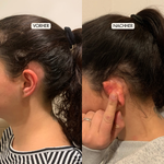 FullHair Haarserum Vorher Nachher Ergebnisse